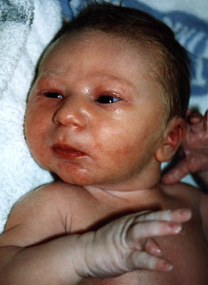 First Face