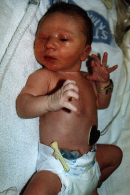 First Photo